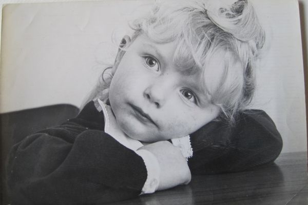 Before: Me at around 3 years old....