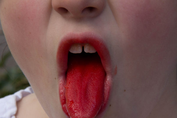 red tounge...